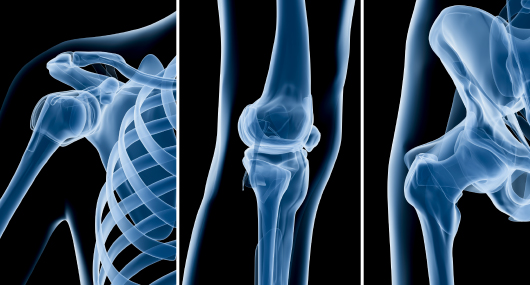 Orthopedics Market White Paper